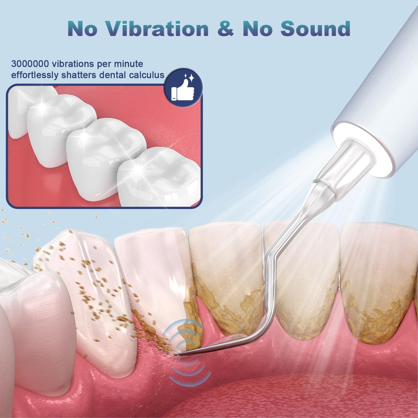 Ultrasonic Dental Plaque Remover for Humans & Pets - Professional Teeth Cleaning Kit for Tartar & Stain Removal, Safe & Gentle Electric Toothbrush for Cats, Dogs and People #SummerVibes